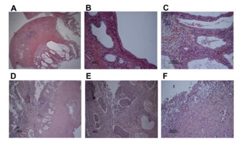 Hình 2 2 Hình ảnh về các phát hiện kiểm tra mô học trong các mô tử cung bị 2