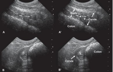 Hình 2 6 Hình ảnh giai đoạn trước động dục ở giống Labrador Retriever 6 tuổi 3