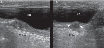 Hình 2 7 Tử cung ở một con chó lai 12 tuổi khỏe mạnh Chú thích A Hình ảnh 4