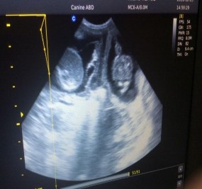 Hình 3 1 Hình ảnh siêu âm thai Hình 3 2 Hình ảnh siêu âm viêm tử cung 3 3 11 1