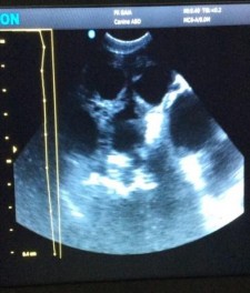 Hình 3 1 Hình ảnh siêu âm thai Hình 3 2 Hình ảnh siêu âm viêm tử cung 3 3 11 2