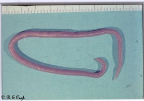 Hình 1 1 Giun đũa trưởng thành Hình 1 2 Trứng giun đũa x 400 Nguồn trích 1