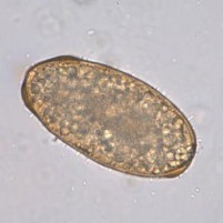 Hình 1 2 Trứng giun đũa x 400 Nguồn trích dẫn http cdc gov parasites Ascariasis 2