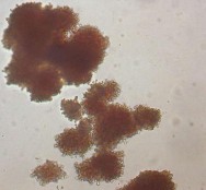 BFU E CFU E Hình 1 1 Các loại cụm hồng cầu khi nuôi cấy Nissen Druey 2005 Có 2 1