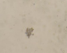 BFU E CFU E Hình 1 1 Các loại cụm hồng cầu khi nuôi cấy Nissen Druey 2005 Có 2 2