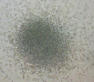 CFU GM CFU G CFU M Hình 1 2 Các loại cụm bạch cầu khi nuôi cấy Nissen Druey 2005 3