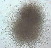 CFU GM CFU G CFU M Hình 1 2 Các loại cụm bạch cầu khi nuôi cấy Nissen Druey 2005 4