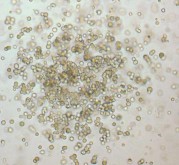 CFU GM CFU G CFU M Hình 1 2 Các loại cụm bạch cầu khi nuôi cấy Nissen Druey 2005 5