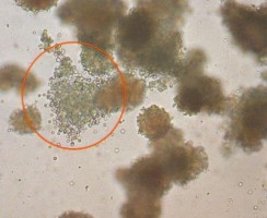 Hình 1 3 Cụm hỗn hợp CFU GEMM Nissen Druey 2005 Điều này phản ánh một tính 6