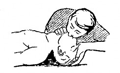 Hình 2 8 Cấp cứu nạn nhân bằng hô hấp nhân tạo Với trẻ em 20 lần trong 1 3