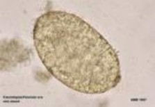 Hình 1 3 Fasciolopsis buski Hình 1 4 Trứng Fasciolopsis buski Gastrodiscoides hominus Sán có 4