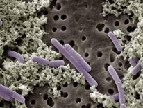 Lactobacillus casei Lactobacillus bulgaricus Oenococcus oeni Lactobacillus brevis Pediococcus 4