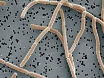 Lactobacillus casei Lactobacillus bulgaricus Oenococcus oeni Lactobacillus brevis Pediococcus 5