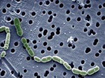 Oenococcus oeni Lactobacillus brevis Pediococcus pentosaceus Brevibacterium linens Hình 1 6 Hình 6