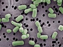 Oenococcus oeni Lactobacillus brevis Pediococcus pentosaceus Brevibacterium linens Hình 1 6 Hình 7