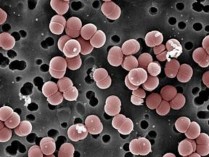 Pediococcus pentosaceus Brevibacterium linens Hình 1 6 Hình thái một số vi khuẩn lactic 8