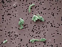 Pediococcus pentosaceus Brevibacterium linens Hình 1 6 Hình thái một số vi khuẩn lactic 9