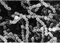 Streptococcus thermophilus Lactobacillus bungaricus Lactococcus lactis Pennicillium roqueforti 1
