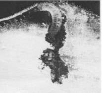 Hình 2 5 Vị trí gây hại của sâu đục vỏ trái Sự gây hại sâu gây hại trong 7