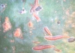 Hình 13 Họ rệp dính Diaspidae Hình 14 Họ rệp sáp giả Pseudococcidae 23