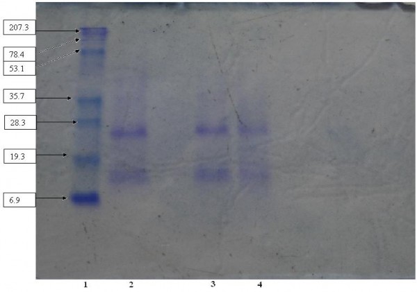 Hình 3 23 Kết quả điện di của dung dịch sau phản ứng ở các hàm lượng xúc 1