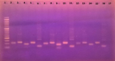 Giếng 1 thang đo 100bp Giếng 2 16 các cặp mồi từ set 1 đến set 4 và mồi β actin 3