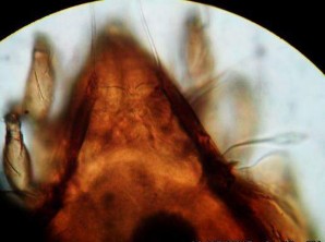 15 B Prosoma với các lông le in ss 15 C Đỉnh ro với đường sejugan đặc trưng 15 D 12