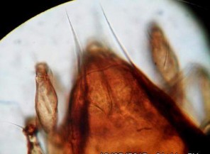 15 B Prosoma với các lông le in ss 15 C Đỉnh ro với đường sejugan đặc trưng 15 D 13