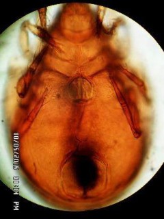 15 D Mặt bụng chú ý phần giáp hậu môn sinh dục vùng AN AG Hình 15 Scheloribates 15