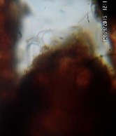 17 C Đỉnh ro với các lông ro 24