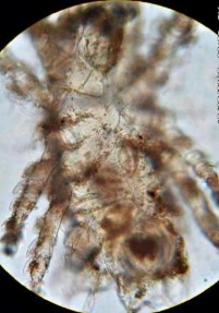 17 D Mặt bụng với vùng giáp sinh dục 17 E Lông cơ thể hình mỏ neo điển hình 1