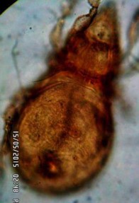 20 B Mặt lưng nhìn nghiêng x 80 20 C Vùng Prosoma với lông ro 20 D Lông ss 3 nhánh 11