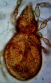 20 B Mặt lưng nhìn nghiêng x 80 20 C Vùng Prosoma với lông ro 20 D Lông ss 3 nhánh 12