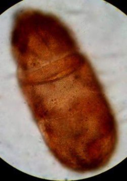 21 A Mặt lưng 21 B Mặt bụng nổi rõ vùng anogenital Hình 21 Papillacarus sp 290 x 610 15