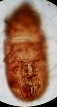 21 A Mặt lưng 21 B Mặt bụng nổi rõ vùng anogenital Hình 21 Papillacarus sp 290 x 610 16