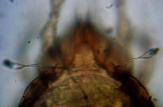 22 A Mặt lưng 22 B Vùng promosome không có đường sejugal 22 C Chân với 3 móng 22 D 18