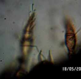 22 C Chân với 3 móng 22 D Mặt bụng Hình 22 Astegistes sp 179 220 x 420 578 µm 23 A Mặt 19