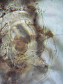 17 D Mặt bụng với vùng giáp sinh dục 17 E Lông cơ thể hình mỏ neo điển hình 2