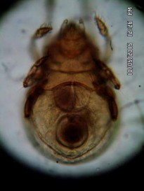 22 C Chân với 3 móng 22 D Mặt bụng Hình 22 Astegistes sp 179 220 x 420 578 µm 23 A Mặt 20