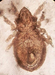 23 A Mặt lưng 23 B Mặt bụng 23 C Vùng AN AG Hình 23 Eremulus sp 354 x 602 µm x 80 x 80 24 22