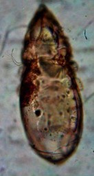 24 A Mặt lưng 24 B Lông ss 24 C Mặt bụng x 80 25 A Mặt lưng 25 B Đường sejugal lưng 24