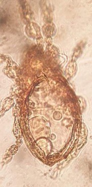 26 A Mặt lưng 26 B Mặt bụng 28