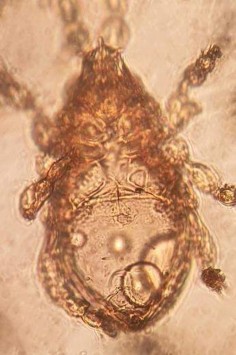 26 A Mặt lưng 26 B Mặt bụng 29