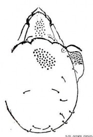 Ảnh gốc theo Vũ Quang Mạnh 2007 18 A Mặt lưng x 80 18 B Prosoma với 3 đường vòng 3