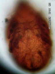 18 B Prosoma với 3 đường vòng cung 18 C Mặt bụng Hình 18 Rostrozetes ovulum ovulum 340 4