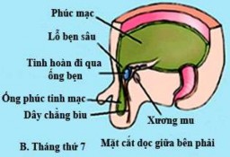 Hình 1 1 Sự di chuyển của tinh hoàn và tạo thành ống phúc tinh mạc Nguồn Moore K 2