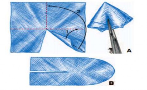Hình 1 10 A Tạo plug B Tấm lưới phẳng Nguồn Pélissier E Palot J P Ngo P 2007 132 1 8 2 1