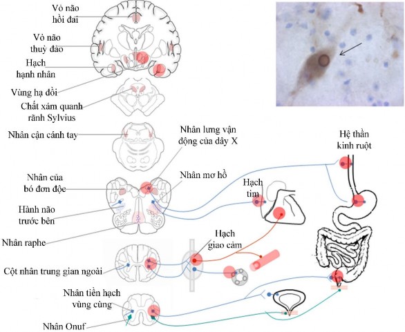 Hình 1 9 Cơ chế sinh bệnh học rối loạn thần kinh tự chủ trong bệnh Parkinson 2