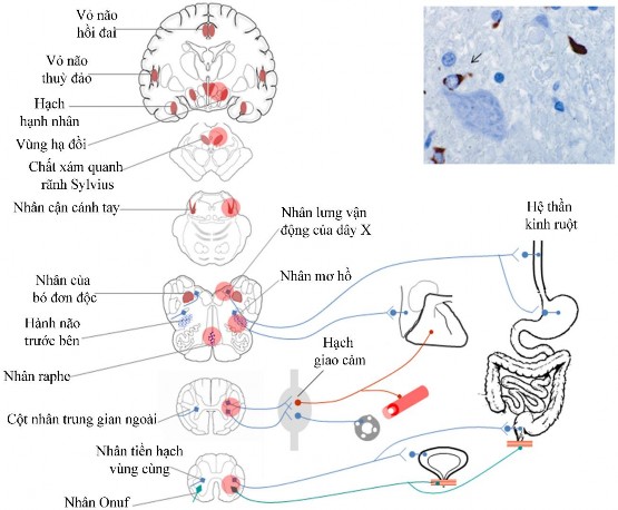 Hình 1 10 Cơ chế sinh bệnh học rối loạn thần kinh tự chủ trong bệnh teo đa 3