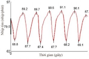 a b Hình 1 11 Test biến thiên nhịp tim với nghiệm pháp hít thở sâu a Bình thường 4